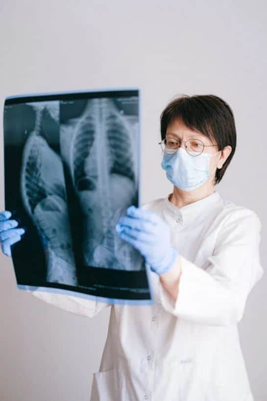 Tomografía computarizada musculoesquelética